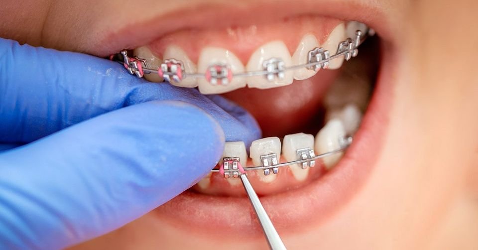 How Can An Orthodontist Help?
