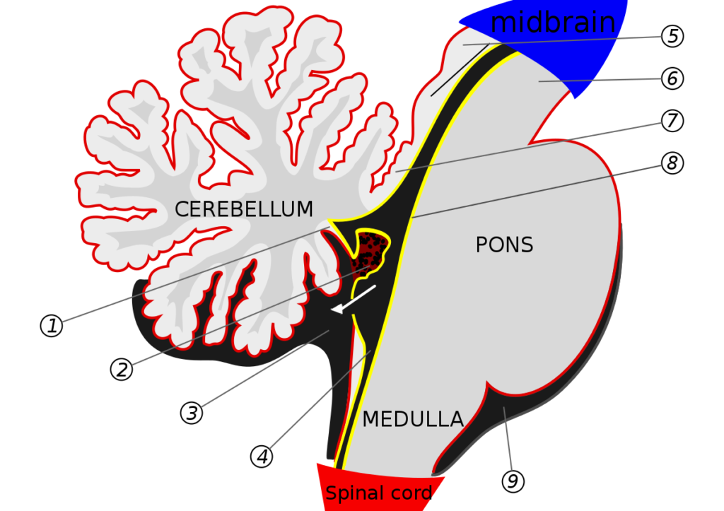 Lateral Aperture