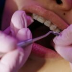 Healthy Habits for Teens with Braces